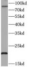 TNF Alpha Induced Protein 3 antibody, FNab10029, FineTest, Western Blot image 