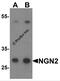 Neurogenin 2 antibody, 7091, ProSci, Western Blot image 