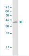 Transcription Elongation Factor A1 antibody, H00006919-M01-100ug, Novus Biologicals, Western Blot image 