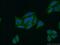Protein Phosphatase 4 Regulatory Subunit 2 antibody, 22676-1-AP, Proteintech Group, Immunofluorescence image 