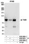 TGF-Beta Activated Kinase 1 (MAP3K7) Binding Protein 3 antibody, A302-208A, Bethyl Labs, Immunoprecipitation image 