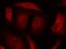 Forkhead Box O3 antibody, PA5-37578, Invitrogen Antibodies, Immunofluorescence image 