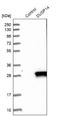 Dual Specificity Phosphatase 14 antibody, NBP1-81046, Novus Biologicals, Western Blot image 