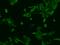 Phosphatidylinositol-3,4,5-Trisphosphate Dependent Rac Exchange Factor 1 antibody, 202113-T02, Sino Biological, Immunohistochemistry paraffin image 