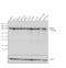 Proteasome 26S Subunit, Non-ATPase 1 antibody, PA1-973, Invitrogen Antibodies, Western Blot image 