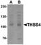 Thrombospondin 4 antibody, orb75795, Biorbyt, Western Blot image 