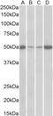 Adhesion G Protein-Coupled Receptor E5 antibody, 43-210, ProSci, Western Blot image 