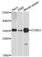 Cyclin D3 antibody, A0746, ABclonal Technology, Western Blot image 
