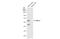 Beta-Secretase 1 antibody, GTX134480, GeneTex, Western Blot image 