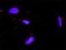 Nuclear Factor Of Activated T Cells 4 antibody, H00004776-D01P, Novus Biologicals, Proximity Ligation Assay image 