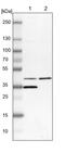 Carbohydrate Sulfotransferase 10 antibody, PA5-53002, Invitrogen Antibodies, Western Blot image 