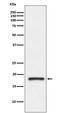 Transthyretin antibody, M00290, Boster Biological Technology, Western Blot image 