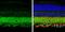 Solute Carrier Family 12 Member 5 antibody, PA5-78544, Invitrogen Antibodies, Immunohistochemistry paraffin image 