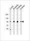 Aconitase 1 antibody, M02781-1, Boster Biological Technology, Western Blot image 