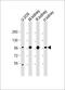 IRP1 antibody, M02781-1, Boster Biological Technology, Western Blot image 