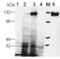 Phosphodiesterase 5A antibody, ALX-210-099-C050, Enzo Life Sciences, Western Blot image 