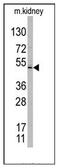 Taspase 1 antibody, AP11325PU-N, Origene, Western Blot image 