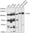 Fc Receptor Like 3 antibody, GTX64975, GeneTex, Western Blot image 