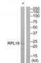 Ribosomal Protein L19 antibody, TA311822, Origene, Western Blot image 