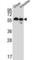 Transmembrane Protein 87B antibody, abx032468, Abbexa, Western Blot image 