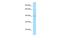 Angiopoietin Like 5 antibody, A14642, Boster Biological Technology, Western Blot image 