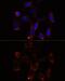 YTH Domain Containing 2 antibody, GTX66320, GeneTex, Immunocytochemistry image 
