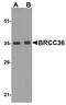 BRCA1/BRCA2-Containing Complex Subunit 3 antibody, A04690, Boster Biological Technology, Western Blot image 