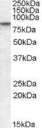 SET Domain Bifurcated Histone Lysine Methyltransferase 2 antibody, PA5-18112, Invitrogen Antibodies, Western Blot image 