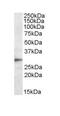 Triggering Receptor Expressed On Myeloid Cells 2 antibody, ab95470, Abcam, Western Blot image 