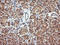 Parvin Alpha antibody, LS-C174632, Lifespan Biosciences, Immunohistochemistry paraffin image 