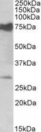 Nicotinamide Nucleotide Adenylyltransferase 3 antibody, TA311572, Origene, Western Blot image 