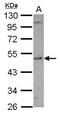 Serine Hydroxymethyltransferase 1 antibody, NBP2-20353, Novus Biologicals, Western Blot image 