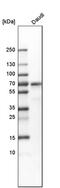 Lymphoid Restricted Membrane Protein antibody, PA5-51789, Invitrogen Antibodies, Western Blot image 