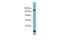 Glutamyl-Prolyl-TRNA Synthetase antibody, GTX46488, GeneTex, Western Blot image 