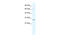 Poly(ADP-Ribose) Polymerase Family Member 11 antibody, 27-944, ProSci, Western Blot image 