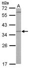OTU Deubiquitinase, Ubiquitin Aldehyde Binding 1 antibody, LS-C185449, Lifespan Biosciences, Western Blot image 