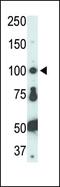 FER Tyrosine Kinase antibody, PA5-14776, Invitrogen Antibodies, Western Blot image 