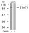 Signal Transducer And Activator Of Transcription 1 antibody, 79-351, ProSci, Western Blot image 