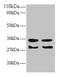 Transforming Growth Factor Alpha antibody, CSB-PA07294A0Rb, Cusabio, Western Blot image 