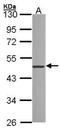 Zinc Finger Protein 277 antibody, NBP1-32228, Novus Biologicals, Western Blot image 