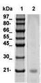 Natriuretic Peptide A antibody, TA354620, Origene, Western Blot image 