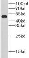 Cholinergic Receptor Nicotinic Alpha 5 Subunit antibody, FNab01677, FineTest, Western Blot image 