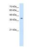 Tetraspanin 12 antibody, NBP1-91297, Novus Biologicals, Western Blot image 