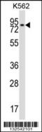 REC8 Meiotic Recombination Protein antibody, 57-127, ProSci, Western Blot image 