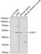 Chitinase 1 antibody, 18-448, ProSci, Western Blot image 