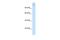 SPT5 Homolog, DSIF Elongation Factor Subunit antibody, PA5-40709, Invitrogen Antibodies, Western Blot image 