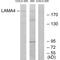 Laminin subunit alpha-4 antibody, A04999, Boster Biological Technology, Western Blot image 