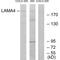 Laminin Subunit Alpha 4 antibody, A04999, Boster Biological Technology, Western Blot image 