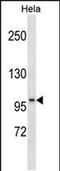Slingshot Protein Phosphatase 1 antibody, PA5-49200, Invitrogen Antibodies, Western Blot image 