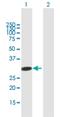 Adenosine Deaminase Like antibody, H00161823-B01P, Novus Biologicals, Western Blot image 